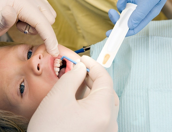 Child receiving fluoride treatment application