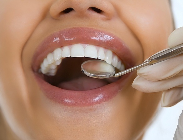 Close up of person smiling while receiving restorative dentistry treatment