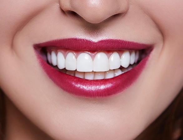 Closeup of smile with gum recontouring