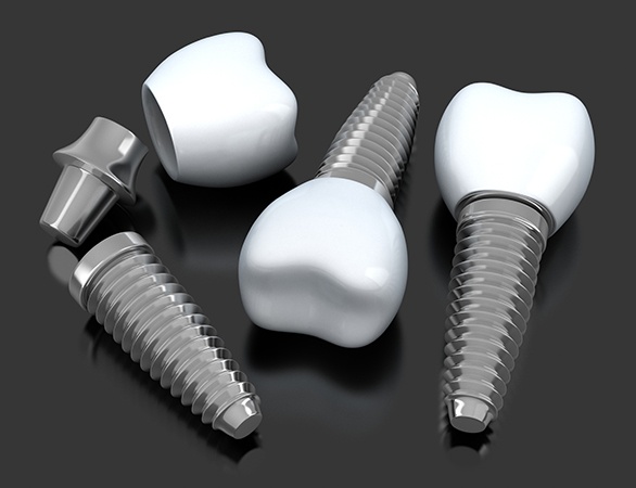 Thre animated dental implant supported dental crowns