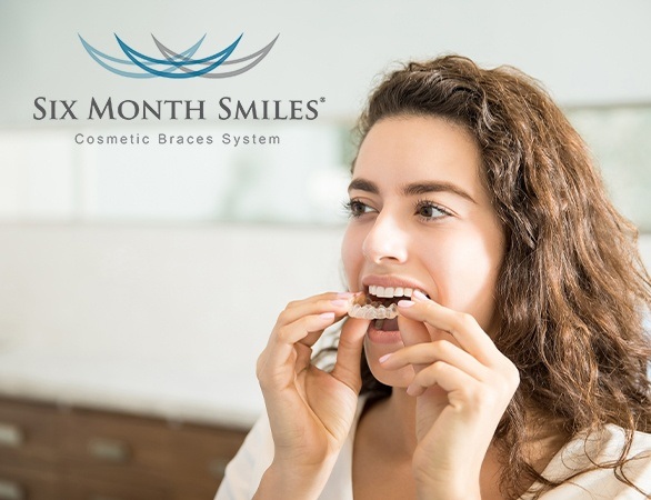 Woman placing clear alignment tray