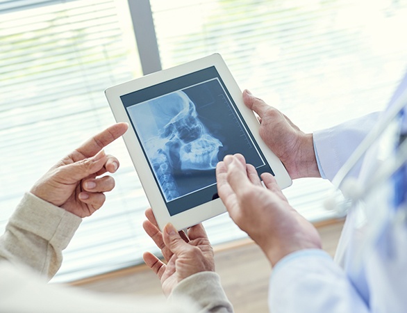 Dentist and team member looking at x-rays of jaw and skull before TMJ therapy