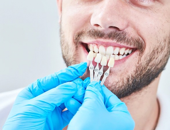 close up of young man getting fitted for veneers in Aurora